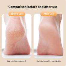 SOKANY Electric Foot Callus Remover, Electric Foot Exfoliator, Removes Dead Skin And Calluses, 2-Speed Adjustable, Type-C Rechargeable (500mAh Lithium Battery), Replaceable Grinding Heads, Washable, Essential For Home And Travel - Multicolor - View 7