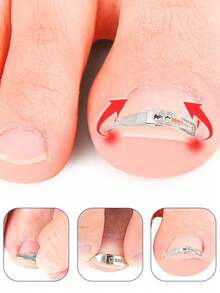 1pc Ingrown Toenail Correction Tool Suitable For Various Types Of Foot Care - Multicolor - View 3
