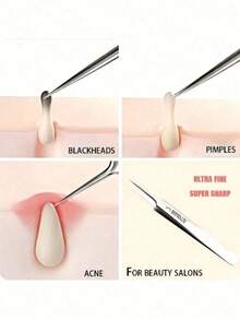 Aguja ultra fina para eliminar puntos negros, adecuada para piel normal, herramienta para eliminar el acné, diseño elegante y duradero, herramienta de cuidado facial de salón de belleza, con bolsa de almacenamiento - Multicolor - Ver 7