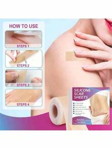 1 Roll Silicone Scar Tape, Medical Grade, Suitable For Wrinkles, Surgical Scars, Keloids And Hypertrophic Scars, Reusable Scar Patch Roll - Multicolor - View 3