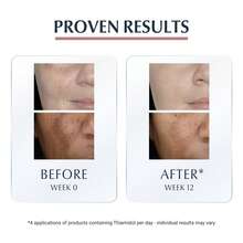 Eucerin سيروم وعلاج الوجه - خيار - مشاهدة 7