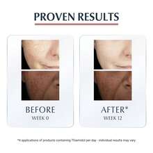 Eucerin سيروم وعلاج الوجه - خيار - مشاهدة 6