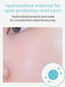 Care Plus 痘痘貼 遮瑕貼，舒適全天佩戴，溫和日常護膚，K-Beauty，Olive Young，禮物 - 24件 - 查看 3