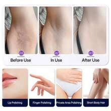 Electric Hair Removal Trimmer Dual Head Shaver Painless Bikini Legs Underarm Body Groomer Portable Rechargeable Cordless Wet Dry Use Razor Epilator - Multicolor - View 5