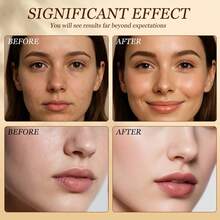 30/60/120pcs Firming Capsule Serum, Barrier Repair, Firming & Smoothing Deep Nourishing For Face And Neck - Hyaluronic Acid - View 5