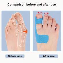 10pcs ODIKER Elastic Toe Care Tape, Pre-Cut Sports Kinesiology Tape, Fragrance-Free, Sports Bandage For Toe Protection And Comfort, Pre-Split Elastic Toe Guard Anti-Friction Inner-Effect Patch For Big Toe Hallux Valgus Fixation Support Sports Bandage Tape - Multicolor - View 2