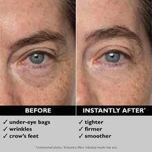 Peter Thomas Roth Instant FIRMx Eye Tensor Temporário Para Os Olhos 30ml - Firmesa, Suavização - 24K Gold Firming Eye Cream - View 3
