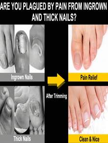 6pcs Ingrown Toenail Care Set - Wide Mouth Large Angle Nail Clipper Suitable For Thick Nails, Includes Nail File And Foot Care Tools, Black Long Handle Nail Clipper, Unisex Manicure & Pedicure Set, Suitable For Halloween, Christmas Gifts - Multicolor - View 11