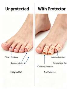 Silicone Toe Caps - Breathable Design, Suitable For Running, Hiking, Skating And Dancing - Soft Washable Elastic Toe Caps, Skin Tone, Finger/Toe Protectors, Toe Separators, Gift For Parents - Multicolor - View 4