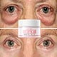 Collagen