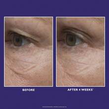 Peter Thomas Roth Ultimate Solution 5™ Multitasking Eye Cream 15ml - Ögonkräm, Återfuktande - Caffeine - Visa 4