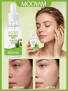 Serum Wajah Pelembap Alpukat MOOYAM, Essence Wajah Pencerah & Bergizi, Hidrasi Mendalam, Secara Signifikan Memperbaiki Kulit Kasar & Kering, Merevitalisasi Kulit Kusam, Perawatan Kulit Harian yang Lembut, Cocok untuk Kulit Sensitif & Semua Jenis Kulit, 30ml - SERUM WAJAH ALPUKAT - View 12