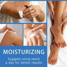 50g 70% Urea And 2% Salicylic Acid Foot Cream, Suitable For Dry, Cracked, Rough And Uneven Skin. Makes Hands And Feet Smoother And Softer. Perfect For Use On Heels, Feet, Hands, Knees And Elbows. An Essential For Daily Moisturizing. - Unscented - View 5
