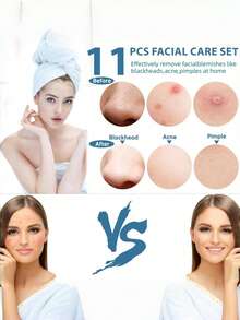Professional Blackhead Removal Set, 3/4/8/11pcs Stainless Steel Acne Needle And Pimple Extractor, With Precise Pimple Squeezing Tool And Storage Box, Suitable For All Skin Types Facial Pore Cleaning Beauty Tool, Gift For Family And Friends, Travel Essential - Silver - View 3