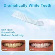 Tiras Clareadoras de Dentes 12D, Clareamento Dental Sem Sensibilidade, Remove Manchas de Café e Chá, Fita Adesiva Ultrafina Portátil, Branqueamento Dentário para Uso Doméstico Adulto - Tiras clareadoras de dentes 12D - Visão 6