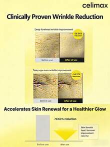 celimax Vita A 视黄醇紧致精华液 | 蕴含 0.1% 视黄醇、3% Matrixyl，高浓度视黄醇抗衰老、收缩毛孔、淡化细纹和皱纹、紧致肌肤，15毫升 - 15毫升 - 查看 5