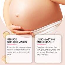 Stretch Mark Creams & Oils - 1 - View 3