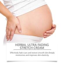 Stretch Mark Creams & Oils - 1 - View 4