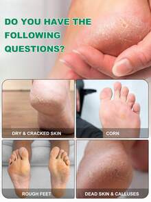 5 Kemasan Masker Pengelupas Kulit Kaki - Masker Kaki Melembapkan & Menutrisi untuk Kaki Kasar & Kering dengan Asam Laktat, Urea & Asam Malat - View 2