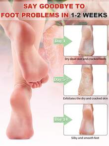 5 Pairs Lactic Acid, Urea And Malic Acid Foot Exfoliating Masks, Suitable For Rough And Dry Feet, Foot Peeling Masks, Moisturizing And Nourishing Feet, Softening Rough Skin, Essence Socks - View 5