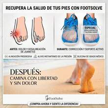 (1 par) Protectores de juanetes y esparcidores de dedos de los pies– Espaciadores de dedos de gel, protectores, correctores - Ver 4