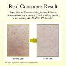 Serums & Facial Treatment - Cream - View 7