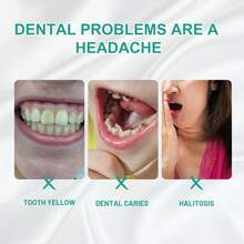 La mousse blanqueadora de dientes con probióticos Oralhoe elimina los malos olores bucales, elimina las manchas en los dientes, protege las encías y blanquea los dientes. Q96Q - 1 - Ver 3