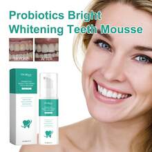 La mousse blanqueadora de dientes con probióticos Oralhoe elimina los malos olores bucales, elimina las manchas en los dientes, protege las encías y blanquea los dientes. Q96Q - 1 - Ver 2