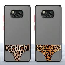 [24h Versand aus DE/FR/ES]Apple 17 16 15 Handyhülle kompatibel mit Xiaomi, kompatibel mit Poco X4 Pro 5G, M5s, C50, C51, X3 NFC, C40, F3, X5, lustiger Leoparden-Muster, Gerätehülle, verspielter Stil, Tiermuster, UV-Muster, kratzfest, elegante Hülle, Poco-Besitzer, Handy-Enthusiasten. - A - Übersicht 2