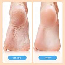Electric Foot Files - Pink - View 5