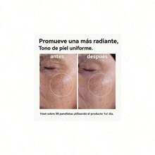 Tónico Exfoliante Acido Glicólico 7% The Ordinary 240ml-Hidratante, Control de Aceite, Reducción de Poros,Anti-envejecimiento,Reparación,lluminador,Calmante,Piel Suave y Radiante - 1PCS - Ver 5