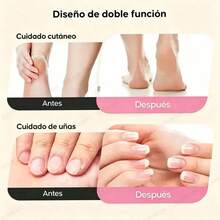 Electric Foot Files - White - View 4