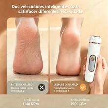 Electric Foot Files - White - View 3