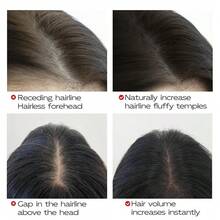 2-In-1 Hairline Filler Stick With Brush, Waterproof, Long-Lasting, Natural Finish, Suitable For All Skin Tones, Used To Cover Gray Roots And Thinning Hair, 5 Pieces - 5-pack - View 3