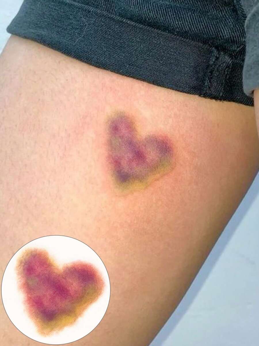 3件組逼真心形瘀青臨時紋身貼紙，防水持久假吻痕紋身，逼真心形傷痕惡搞禮物，適合惡作劇、情侶、萬聖節服裝派對