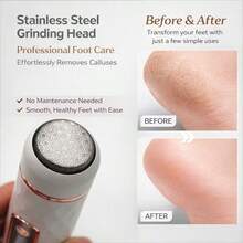 Electric Foot Callus Remover, Rechargeable Portable Foot File, 2 Brush Heads, Foot Care, Remove Dead Skin And Callus, Suitable For Men And Women, Foot Care Tool - A - View 4