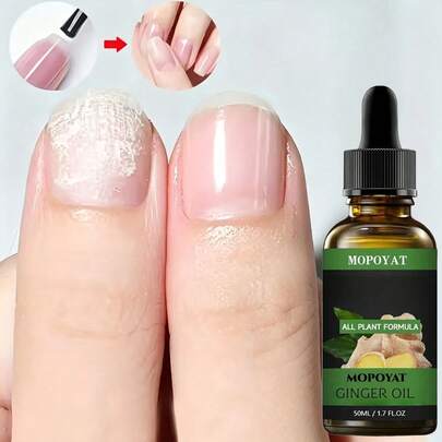 Aceite esencial de jengibre MOPOYAT, fórmula suave para el cuidado de los pies, con aroma a jengibre, multiusos, apto para pies y uñas, apto para todo tipo de piel. Beige claro, 50 ml.(1pc/3pcs)