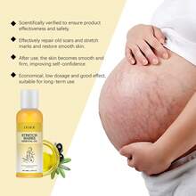 OUHOE 100ml Stretch Mark Removal Oil Remove Pregnancy Stretch Marks Postpartum Care Regain Skin Flexibility & Elasticity Soothes Dry & Tense Refreshing Not Greasy Body Care Oil - Stretch Mark Oil - View 6