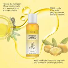 OUHOE 100ml Stretch Mark Removal Oil Remove Pregnancy Stretch Marks Postpartum Care Regain Skin Flexibility & Elasticity Soothes Dry & Tense Refreshing Not Greasy Body Care Oil - Stretch Mark Oil - View 9