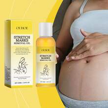 OUHOE 100ml Stretch Mark Removal Oil Remove Pregnancy Stretch Marks Postpartum Care Regain Skin Flexibility & Elasticity Soothes Dry & Tense Refreshing Not Greasy Body Care Oil - Stretch Mark Oil - View 2