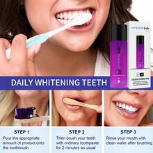 Teeth Whitening - 1 - View 2