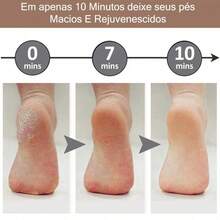 Lixador de Pé F Elétrico - Esfoliador Tira Calos Pedicure Portátil  yobel - 1un - Visão 11