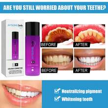 Teeth Whitening - 1 - View 3
