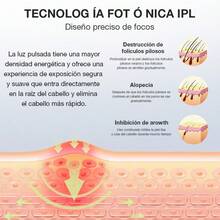 Epilators - View 3