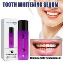 Teeth Whitening - 1 - View 4