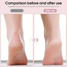 Electric Foot File For Calluses Removal, Rechargeable Pedicure Tool With 2 Interchangeable Heads, 2 Speeds,Home Use Dead Skin Remover - A - View 6