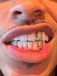 THATBOY 6pcs/Set Gigi Tiruan Berlapis Emas 18K, Penutup Gigi Atas Tunggal - Cocok Untuk Pesta Dan Pemakaian Sehari-hari - Tema Liburan - Batu Kelahiran Desember - Batu Sintetis - MultiWarna - View 4
