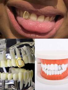 THATBOY 6pcs/Set Gigi Tiruan Berlapis Emas 18K, Penutup Gigi Atas Tunggal - Cocok Untuk Pesta Dan Pemakaian Sehari-hari - Tema Liburan - Batu Kelahiran Desember - Batu Sintetis - MultiWarna - View 6
