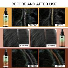Goiple 2.7fl.Oz Lace Hair Dye Spray, Waterproof Lace Blending Spray, Wig Knot Concealer, Suitable For Hair Extensions, Lace Wigs, Quick-Dry Formula, Matches Skin Tone, Suitable For Daily Wig Wear And Cosplay (Brown/Reddish Brown/Golden Brown) - Dye Spray - View 6