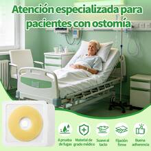 Pulsovital Kit Anillos de Barrera Cutánea para Ostomía Espesor 2mm y 4mm, Moldeables Hidrocoloide Recortables 20‑40mm / 40‑70mm, Resistente a Fugas, 20 Pcs Total - Albaricoque - Ver 4